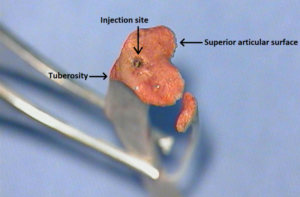 Osteomyelitis Rat Model